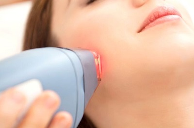 Laser hair removal