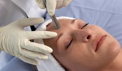 microdermabrasion treatments